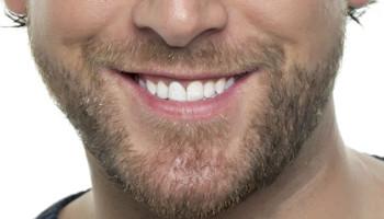 4 Tips to Tackle Beard Patchiness